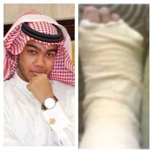 مهدي يتعرض لإصابة في قدمه