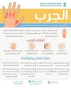 حملات وقائية لتصدي “الجرب” في مدارس الشرقية