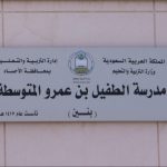 المملكة تجري أول عملية تصغير معدة بالمنظار لزارع كلى